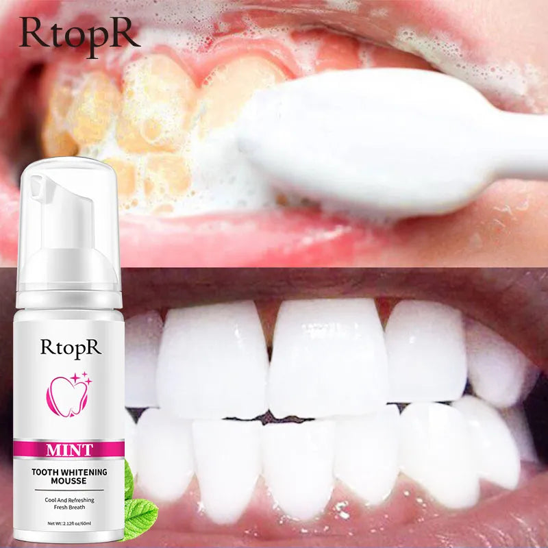 Teeth Cleansing Whitening Mousse Toothpaste  Removes Stains Oral Hygiene