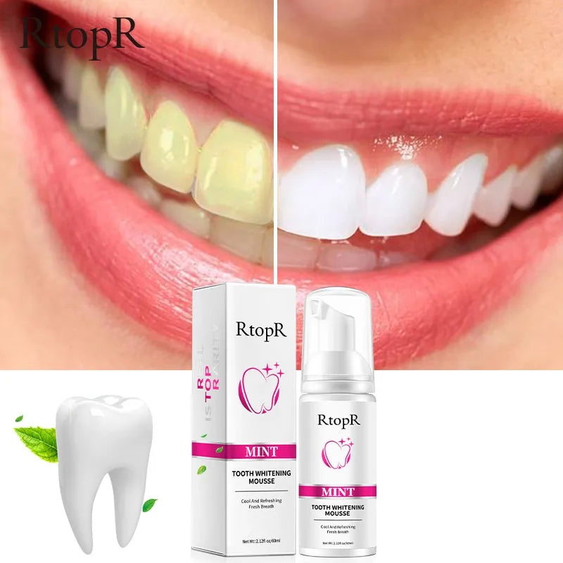 Teeth Cleansing Whitening Mousse Toothpaste  Removes Stains Oral Hygiene