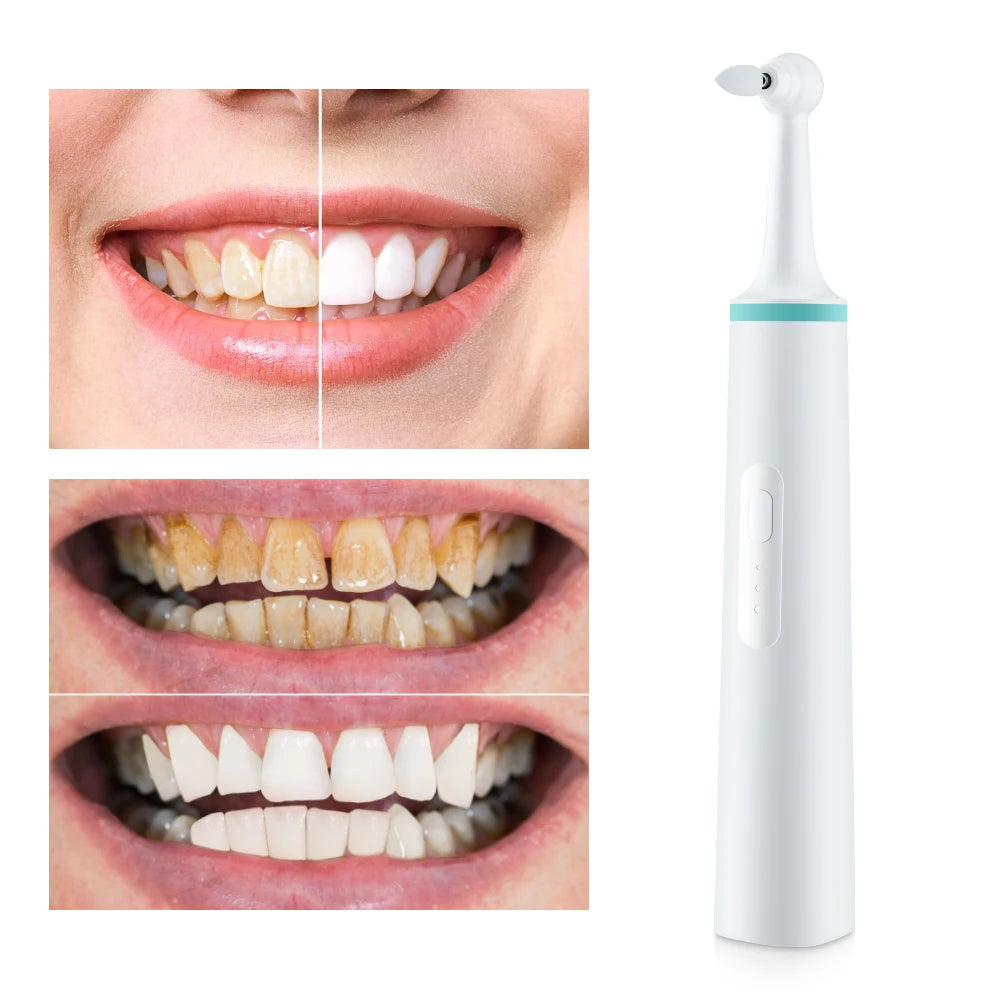 Professional Dental Tooth Polisher Teeth Whitening Cleaning Calculus Tartar Stain Plaque Remover Hygiene