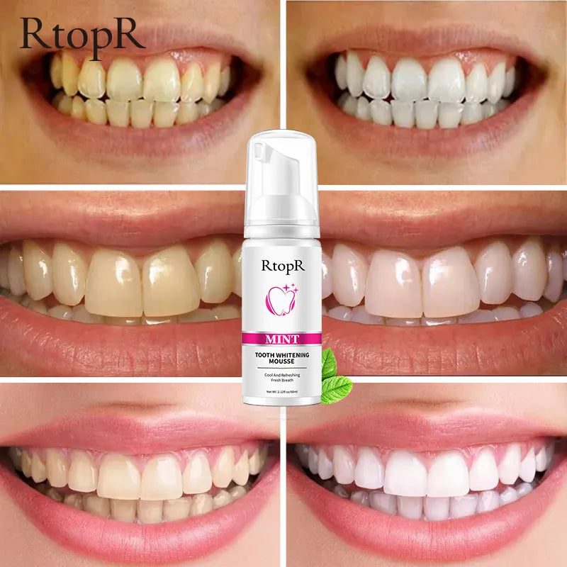 Teeth Cleansing Whitening Mousse Toothpaste  Removes Stains Oral Hygiene